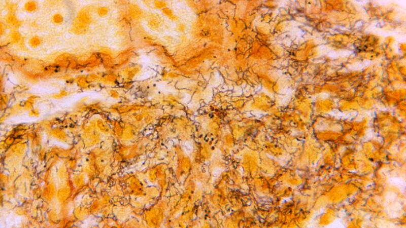 This 1966 microscope photo made available by the Centers for Disease Control and Prevention...